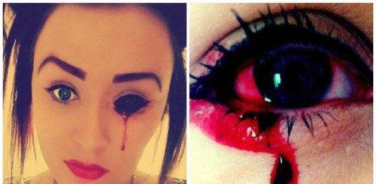 El extraño caso de la chica que sangra por los ojos y oídos El extraño caso de la chica que sangra por los ojos y oídos