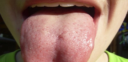 ¿De verdad podrías tragarte la lengua?