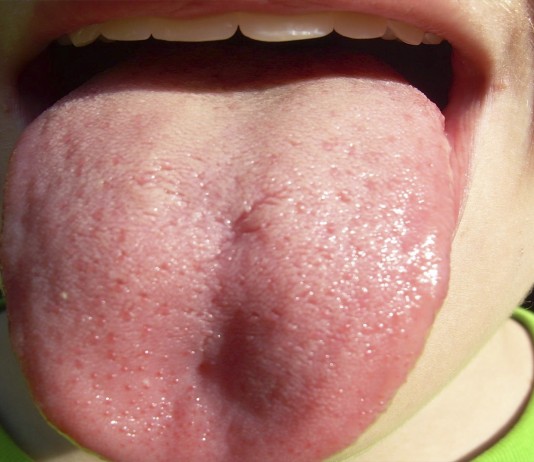 ¿De verdad podrías tragarte la lengua? ¿De verdad podrías tragarte la lengua?