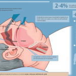 apnea del sueño infografía