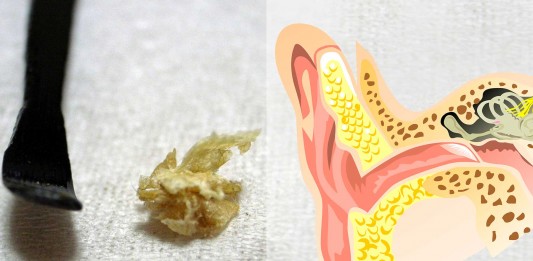 De qué está hecha la cera de oreja