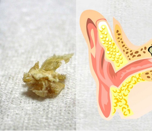 De qué está hecha la cera de oreja De qué está hecha la cera de oreja