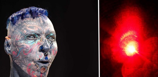 ¿Sabes cómo se quita un tatuaje?