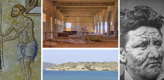 Los últimos leprosarios del siglo XX Los últimos leprosarios del siglo XX