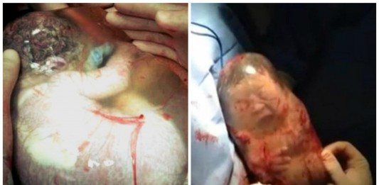 ¡Maravilloso! Descubre cómo es un nacimiento «velado» ¡Maravilloso! Descubre cómo es un nacimiento velado