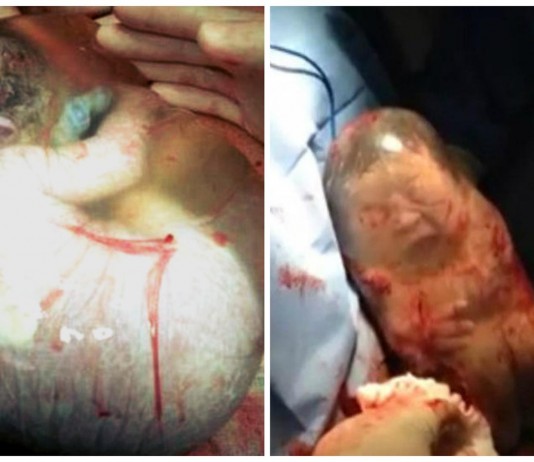 ¡Maravilloso! Descubre cómo es un nacimiento velado