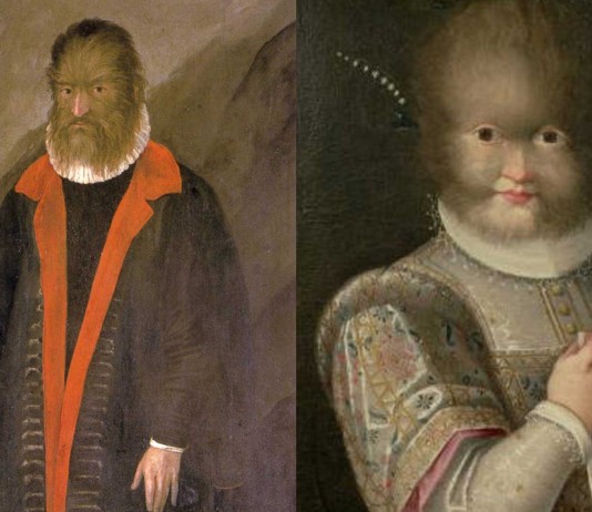 Petrus Gonsalvus, el hombre lobo canario