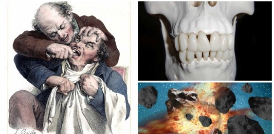 ¿Puede explotar una muela?