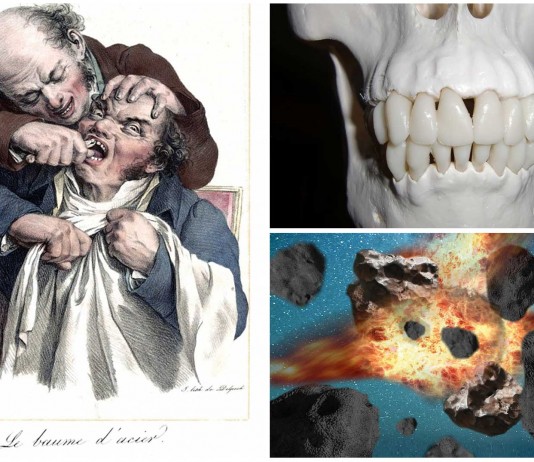 ¿Puede explotar una muela?