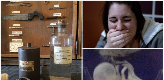 ¿Se puede vomitar un feto? ¡Conoce este caso! ¿Se puede vomitar un feto? ¡Conoce este caso!