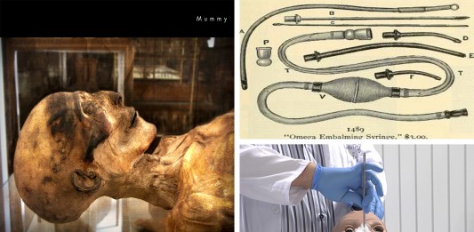 ¿Cómo se embalsama un cadáver? Las 5 fases ¿ Cómo se embalsama un cadáver ? Las 5 fases