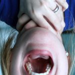 ¿Sientes un nudo en la garganta? ¡Descubre por qué!