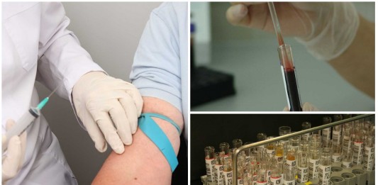 ¿De verdad es necesario hacernos los análisis en ayunas?