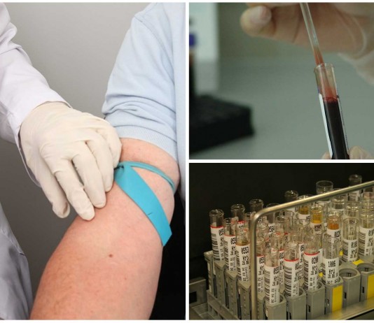 ¿De verdad es necesario hacernos los análisis en ayunas? ¿De verdad es necesario hacernos los análisis en ayunas?