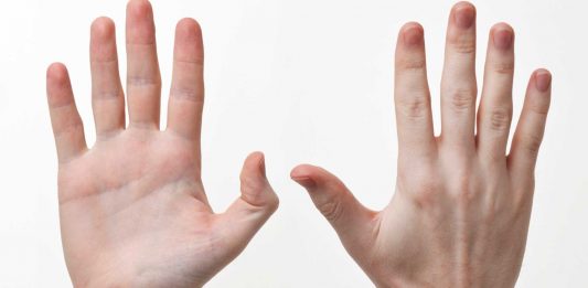 ¿Alguna vez confundes derecha e izquierda? ¡Quizá seas bilateral!