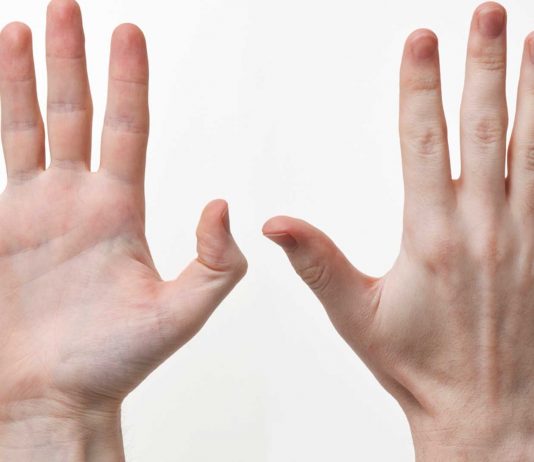 ¿Alguna vez confundes derecha e izquierda? ¡Quizá seas bilateral!