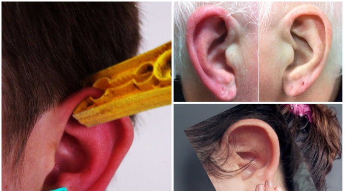 El misterioso síndrome de "la oreja roja"