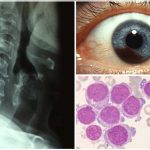 13 datos sobre el cáncer que quizá ignorabas