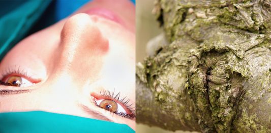 La moda adolescente de la cirugía genital con fines estéticos La moda adolescente de la cirugía genital con fines estéticos