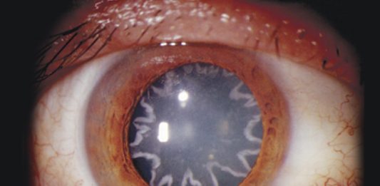 El hombre con una estrella en el ojo