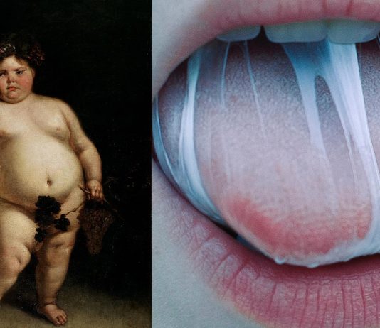 El síndrome de Prader-Willi "comer sin parar hasta morir"