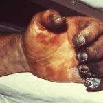 5 grandes pandemias de la antigüedad ¡Terribles!