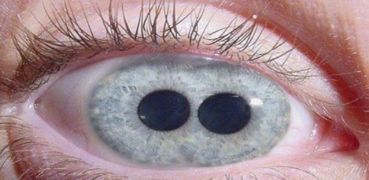 ¿Es posible tener dos pupilas en un mismo ojo? ¿Es posible tener dos pupilas?