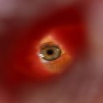 Una antigua epidemia encubierta: la sífilis