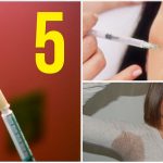 5 cosas para las que el bótox sí te puede ayudar