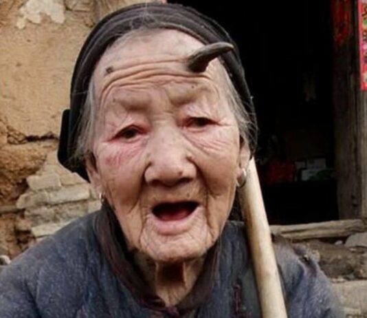 Personas con cuernos en la cabeza | Casos reales e increíbles Personas con cuernos en la cabeza Supercurioso