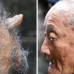 enfermedades raras Supercurioso