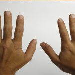 5 datos que tus manos pueden revelar sobre tu salud