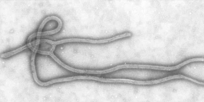 Rusia supera las pruebas de una vacuna contra el Ébola