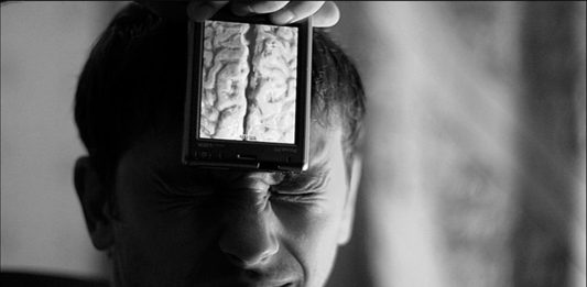 Científicos en shock: perdió un 50-70% del cerebro y está... bien