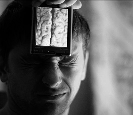 Científicos en shock: perdió un 50-70% del cerebro y está… bien Científicos en shock: perdió un 50-70% del cerebro y está... bien