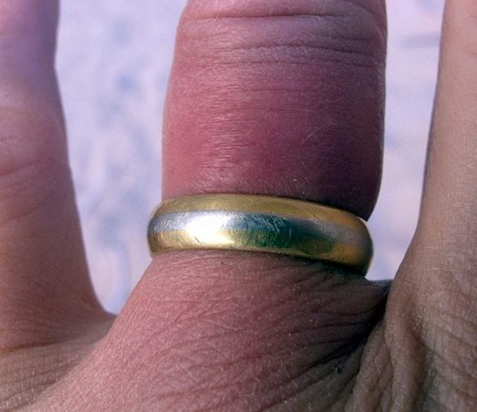 5 Trucos para sacar un anillo atascado en un dedo