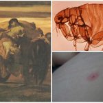 Cómo la pulga contagia la PESTE NEGRA