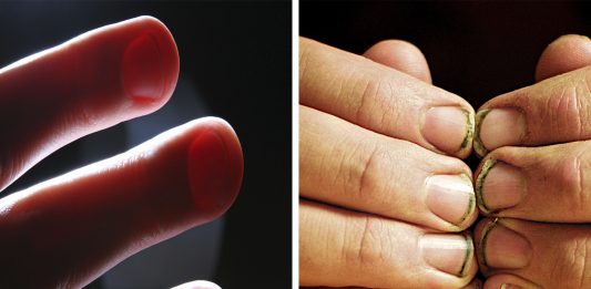 Lo que hay bajo tus uñas...