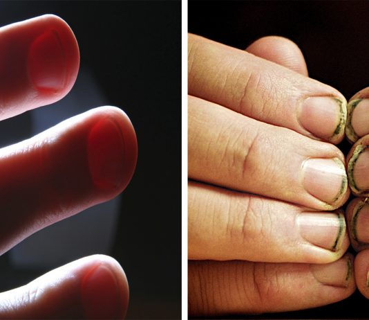 Lo que hay bajo tus uñas...