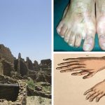 6 dedos en cada pie: así te tratarían las culturas pre-colombinas