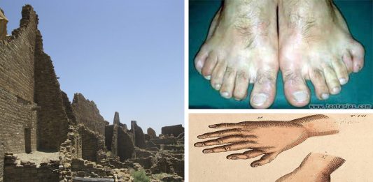 6 dedos en cada pie: así te tratarían las culturas pre-colombinas