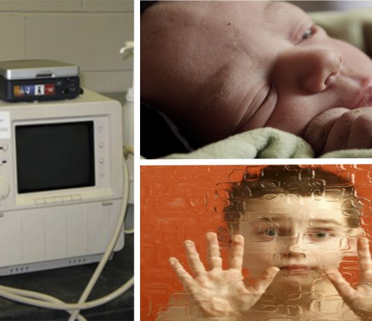 ¿Se puede predecir el autismo con ultrasonido en niños recién nacidos?