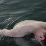 5 síndromes súper raros que puedes sufrir