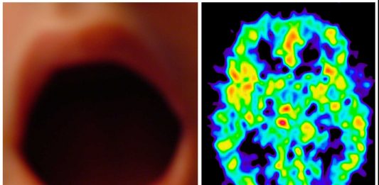 Mira lo que ocurre en tu cerebro durante un orgasmo