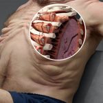 cuerpo accidente de coche