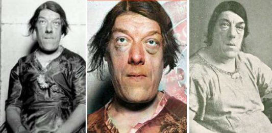 ¿La mujer más fea del mundo? La historia de Mary Ann Bevan