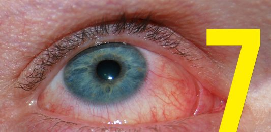 Las 7 alergias más extrañas que hayas conocido