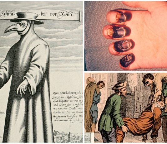 La Peste: 6 datos que quizá ignorabas de tan horrible enfermedad La Peste: 6 datos que quizá ignorabas de tan horrible enfermedad