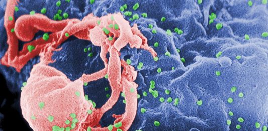 ¿Sabes cuánto hace que existe el VIH? Te horrorizará