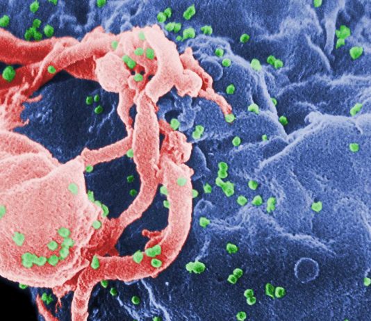 ¿Sabes cuánto hace que existe el VIH? Te horrorizará ¿Sabes cuánto hace que existe el VIH? Te horrorizará